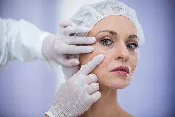 acne scars
